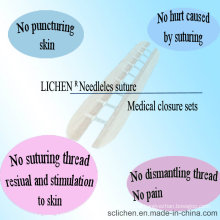 All Types Surgical Suture No Needle Disposable Medical Equipment